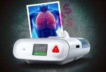 En pandemia repartieron 2 mil ventiladores Philips defectuosos en 255 hospitales