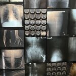 Héctor de Anda. Autoradiográficas: el cuerpo interior. Intervención artística en el Museo Universitario del Chopo