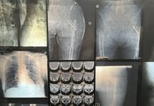 Héctor de Anda. Autoradiográficas: el cuerpo interior. Intervención artística en el Museo Universitario del Chopo