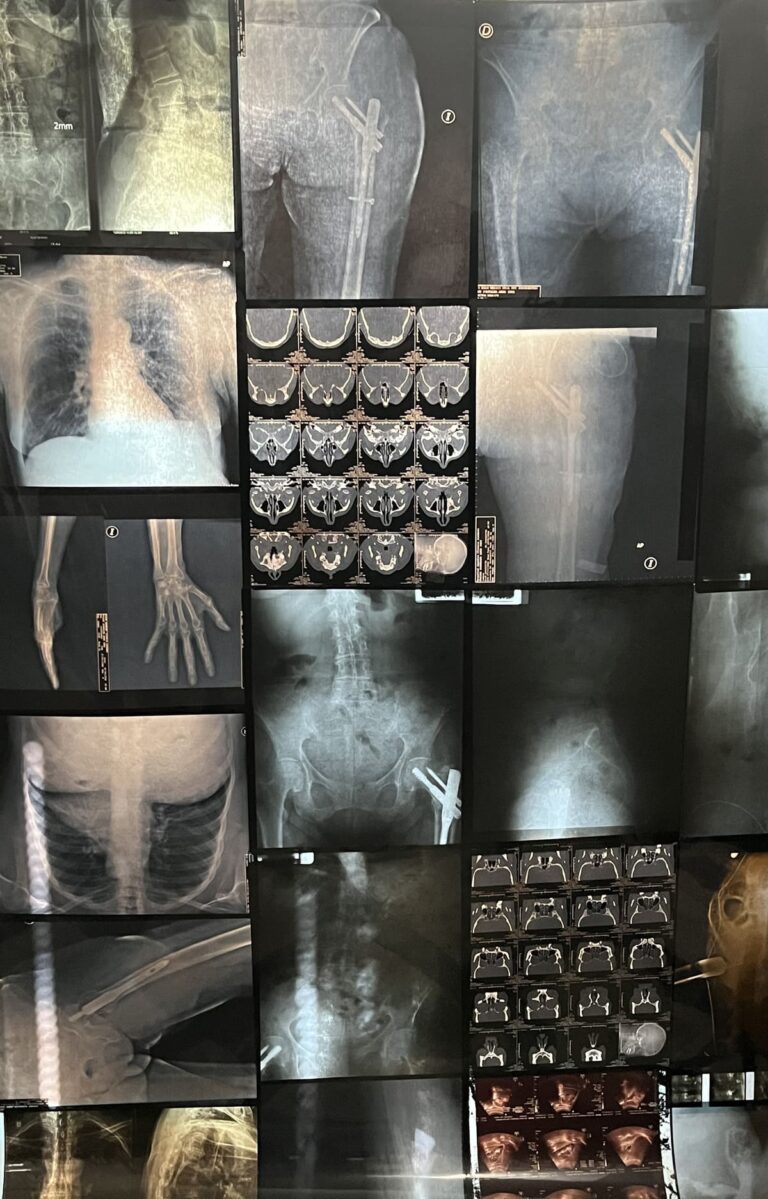 Héctor de Anda. Autoradiográficas: el cuerpo interior. Intervención artística en el Museo Universitario del Chopo
