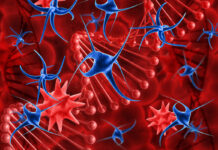 Mieloma múltiple en México: Más de 2 mil casos por este cáncer a nivel nacional