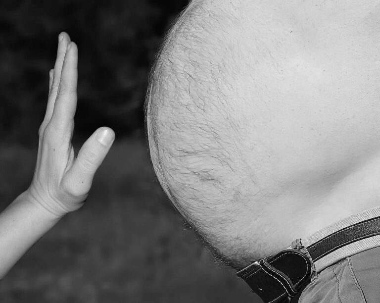 Día Mundial de la Obesidad. Cerca de la mitad de la población mexicana tendrá sobrepeso en 2030: necesario promover una atención médica integral