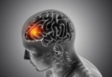 Las personas ‘sanas’ y jóvenes también pueden presentar un infarto cerebral