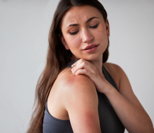 8 de cada 10 casos de dermatitis atópica en mujeres aparecen por primera vez durante el embarazo