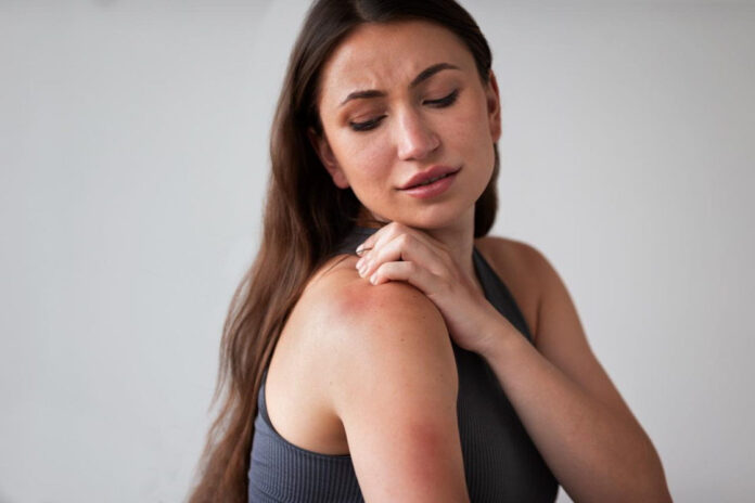 Nota dermatitis